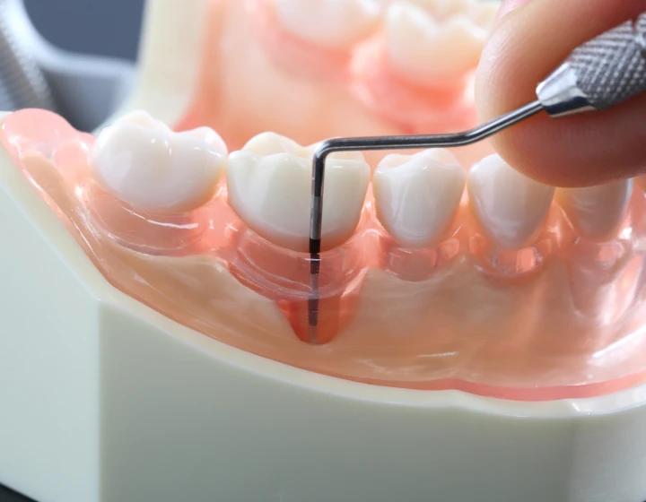 口腔内の診査