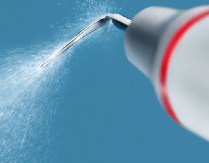 残った歯石を除去