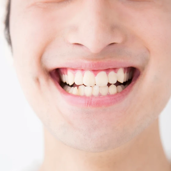 歯肉の炎症が改善