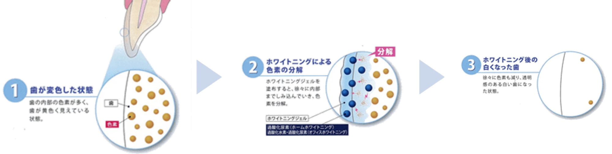 白くなるメカニズム