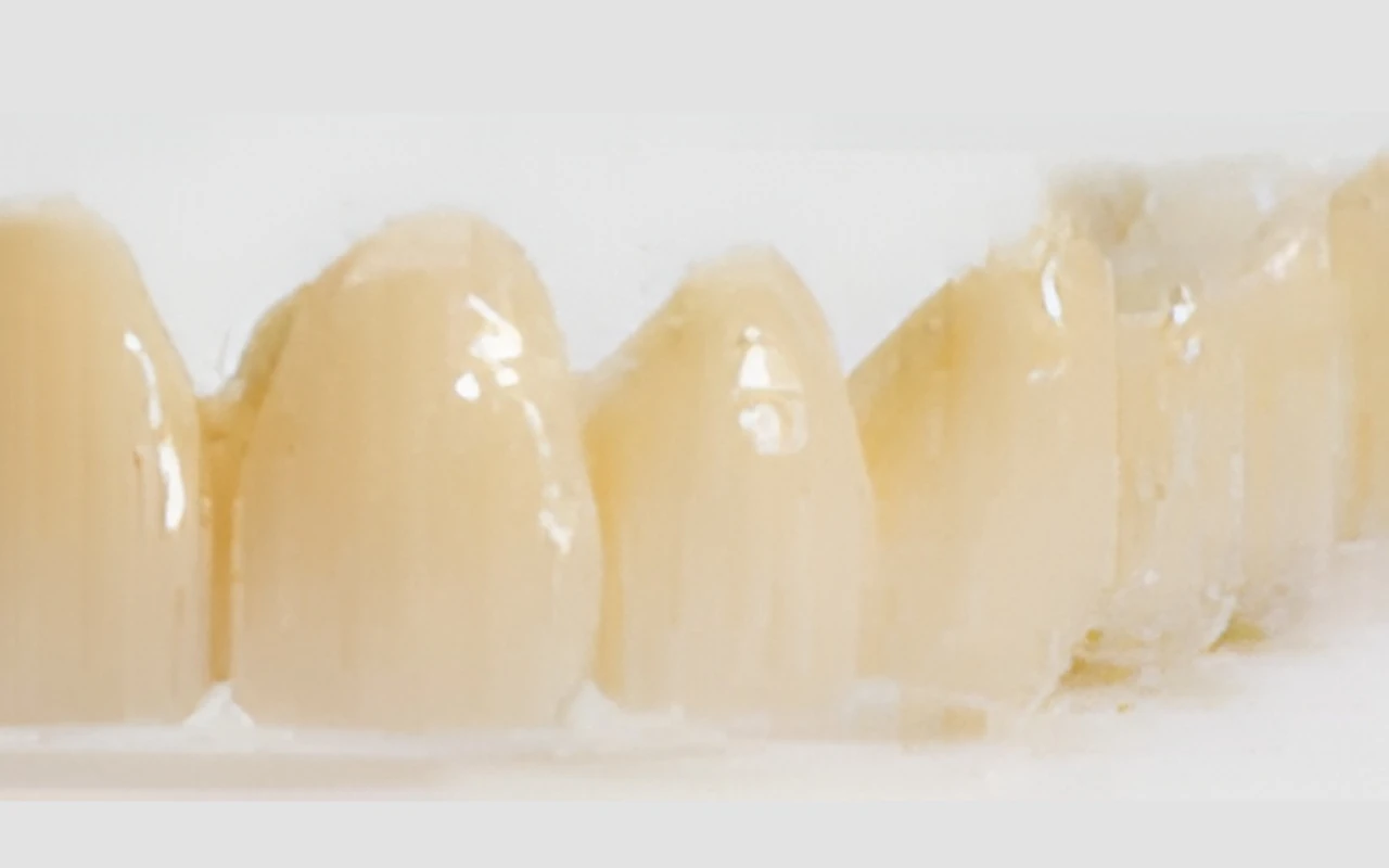 オールセラミック