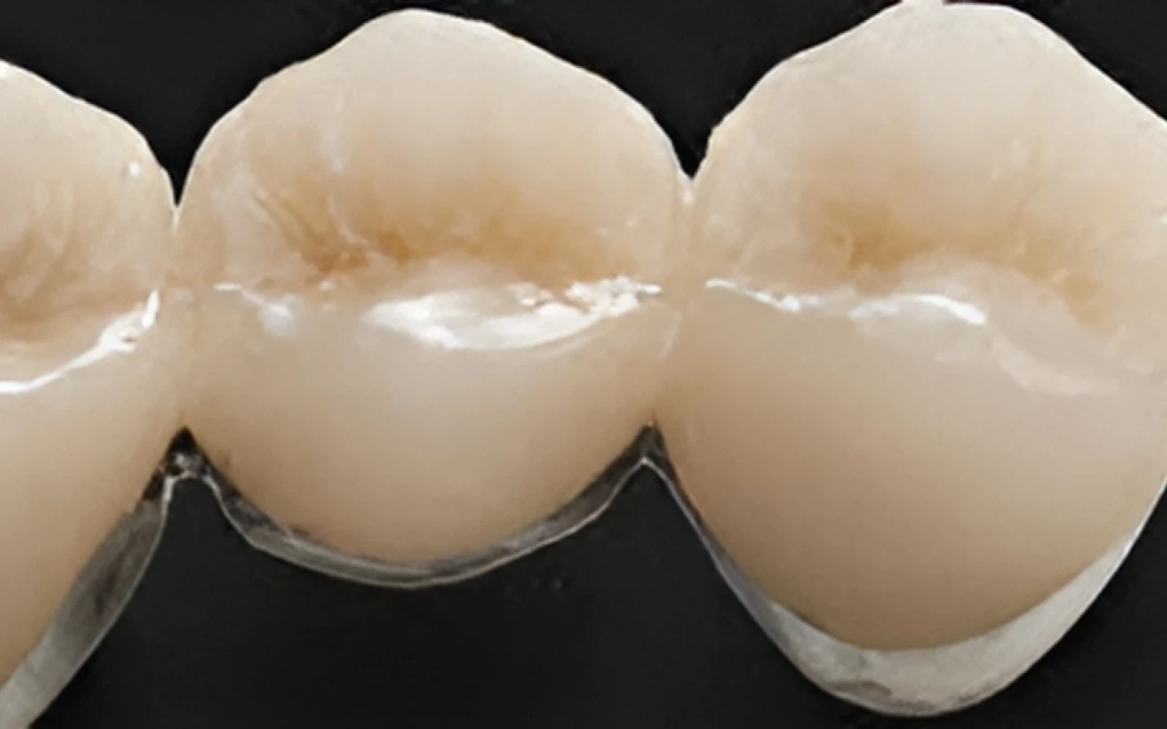 ハイブリッドセラミック