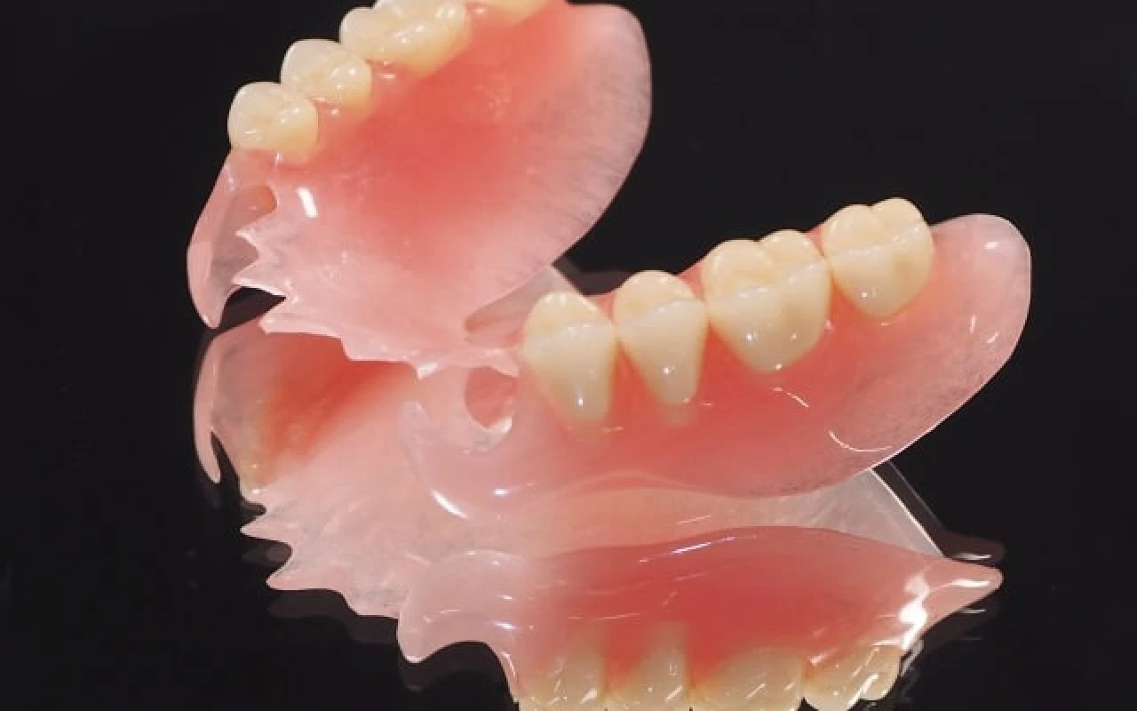 ノンクラスプデンチャ－