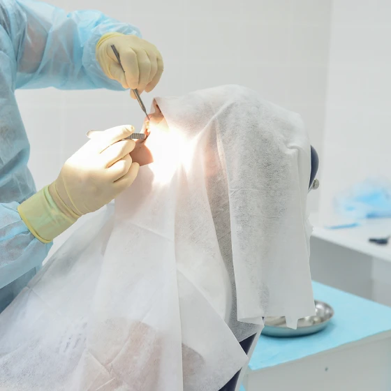 二次手術・人工歯の取り付け